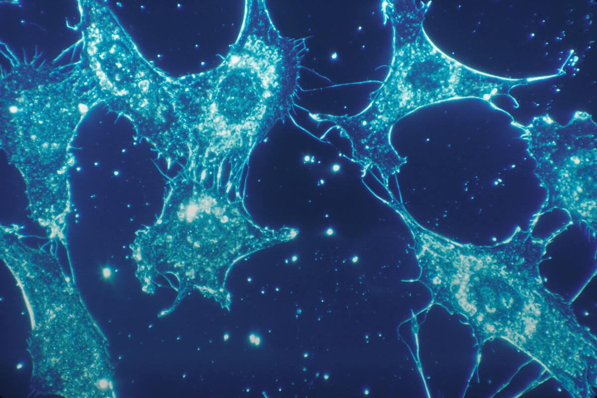 Human tissue under microscope
